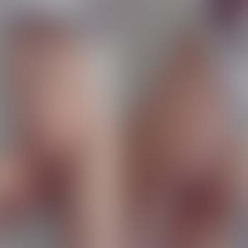 Les deux côtés de la médaille avec une transex de Bar-le-Duc 55